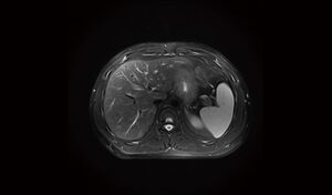ny-pro3lctx1